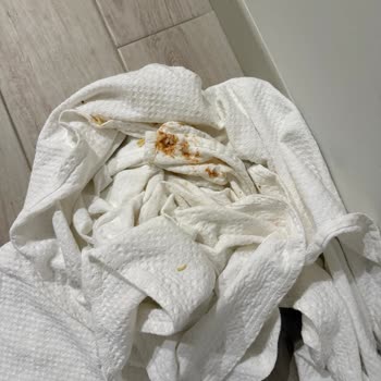 Otel Kaynaklı Gıda Zehirlenmesi Ve İlgisiz Yönetim