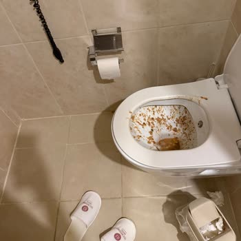 Otel Kaynaklı Gıda Zehirlenmesi Ve İlgisiz Yönetim