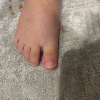 Bebek Ayakkabısı Ayağa Zarar Verdi, İade Talebim Reddedildi