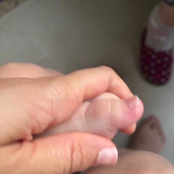 Bebek Ayakkabısı Ayağa Zarar Verdi, İade Talebim Reddedildi