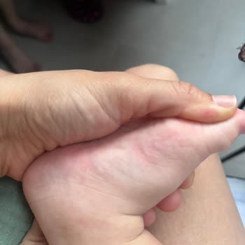 Bebek Ayakkabısı Ayağa Zarar Verdi, İade Talebim Reddedildi