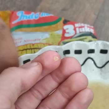 Aldığımız Noodle İçinden Sert Cisim Çıktı, Kardeşim Kustu