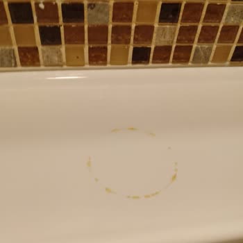 Gloria Tibi Gümbet Otelde Hijyen Eksikliği Ve Ücret İadesi Sorunu