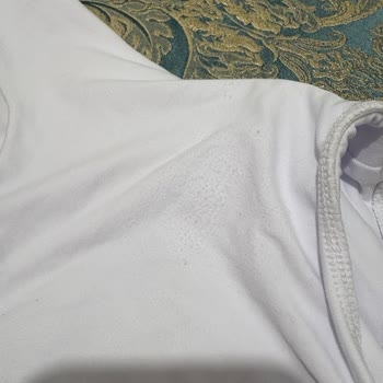 Zara'dan Alınan Ürünün Kalitesizliği Ve İade Sorunu