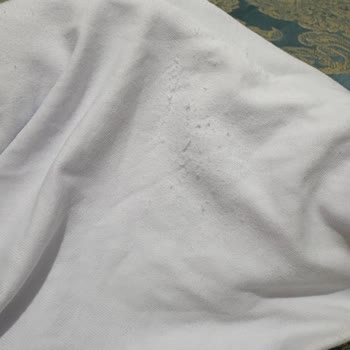 Zara'dan Alınan Ürünün Kalitesizliği Ve İade Sorunu