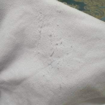 Zara'dan Alınan Ürünün Kalitesizliği Ve İade Sorunu