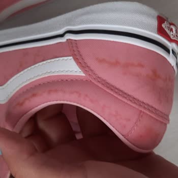 Yeni Alınan Vans Ayakkabının Rengi Paslandı İade Talebim Reddedildi