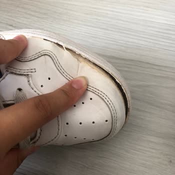 Adidas Sneaker Kısa Sürede Yırtıldı, Garanti Sorunu Yaşadım