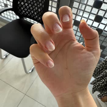 Protez Tırnak Çıkartma Sonrası Kötü Deneyim