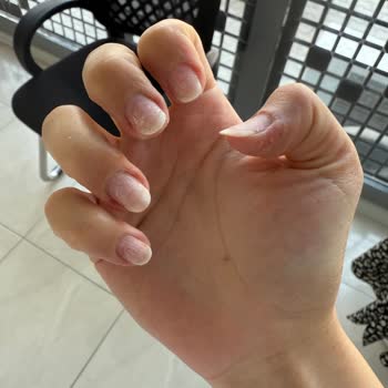 Protez Tırnak Çıkartma Sonrası Kötü Deneyim