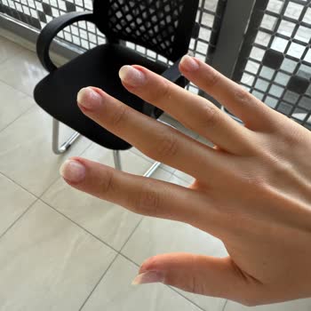 Protez Tırnak Çıkartma Sonrası Kötü Deneyim