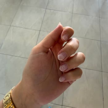 Protez Tırnak Çıkartma Sonrası Kötü Deneyim