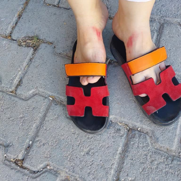 Hotiç Terlik Ayağımı Boyadı, Şikayetim Sonuçsuz Kaldı