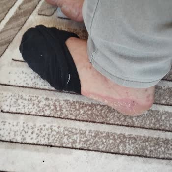 Boyner Aldığım Ayakkabı Sağlığımı Tehlikeye Attı