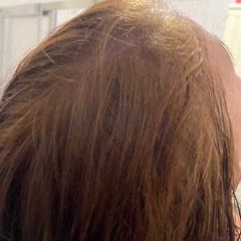 Saç Boyası Yerine Renk Açıcı: Büyük Hata!