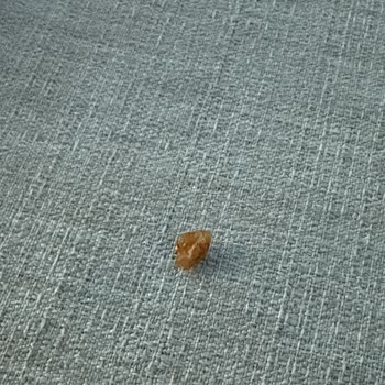 Hoşbeş Gofretin İçinden Taş Çıktı, Dişim Ağrıdı