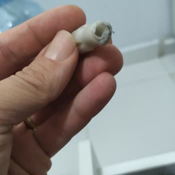 Yeni Alınan Mutfak Robotunda Motor Dişlisi Arızası Ve Garanti Kapsamı Sorunu