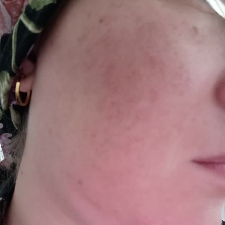 Bee Beauty Yüz Güneş Kremi Alerji Ve Sivilce Yaptı Pişmanlık Yaşadım