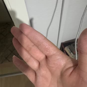 Güneş Kreminde Beklenmedik Soyulma Sorunu