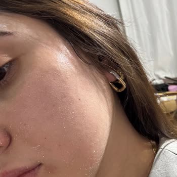 Güneş Kreminde Beklenmedik Soyulma Sorunu