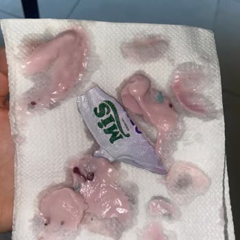 Son Kullanma Tarihi Geçmemiş Orman Meyveli Yoğurt Küflü Çıktı