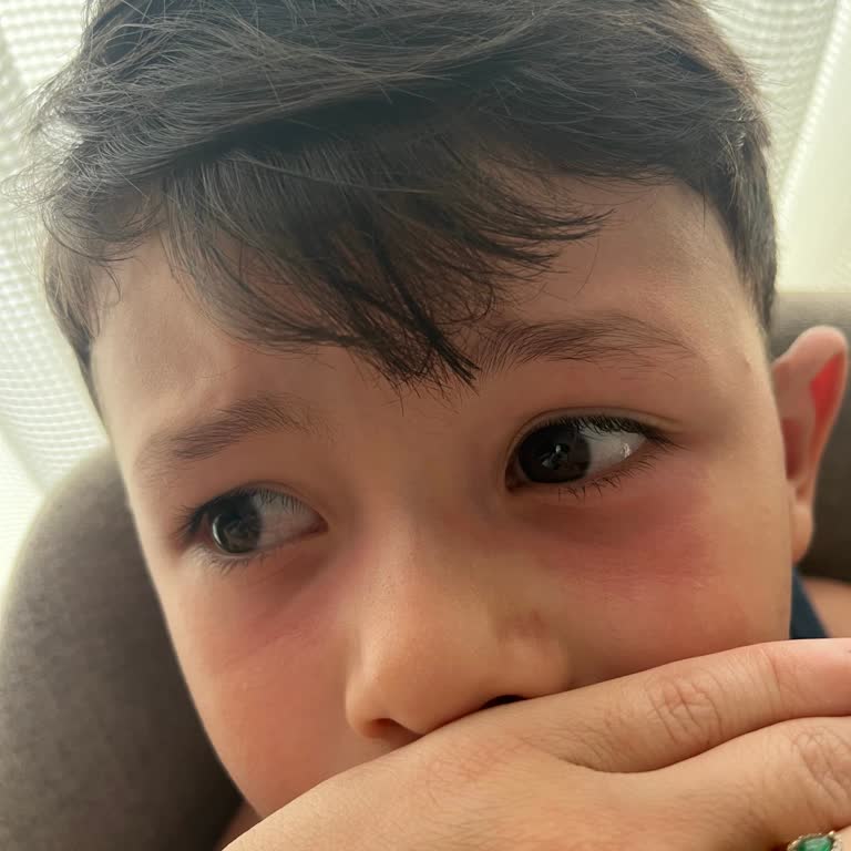 Nivea Çocuk Güneş Kremi Ciltte Kızarıklık Ve Koruma Eksikliği Yaşattı