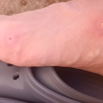 Satın Alınan Terlikte Kalite Sorunu ve Memnuniyetsizlik