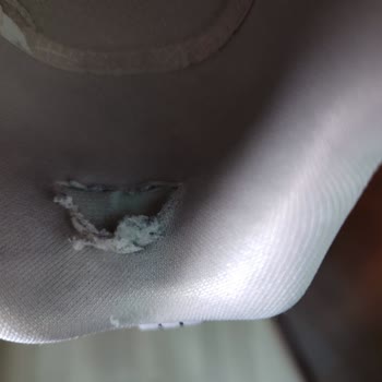 Skechers Ayakkabı 2 Ayda Yırtıldı, İnceleme Sonucu Olumsuz!