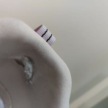 Skechers Ayakkabı 2 Ayda Yırtıldı, İnceleme Sonucu Olumsuz!