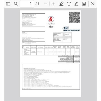 Skechers Ayakkabı 2 Ayda Yırtıldı, İnceleme Sonucu Olumsuz!