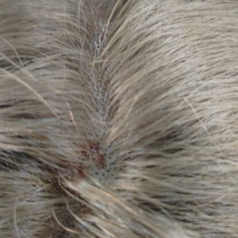 Saç Derimde Yanık Oluştu, Fatura Verilmedi Ve Mağdur Edildim