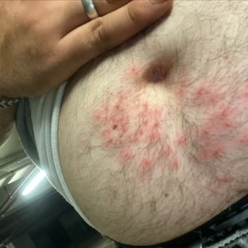 Yanlış Uygulama Sonucu Oluşan Yaralar Ve İlgisiz Hizmet Deneyimi