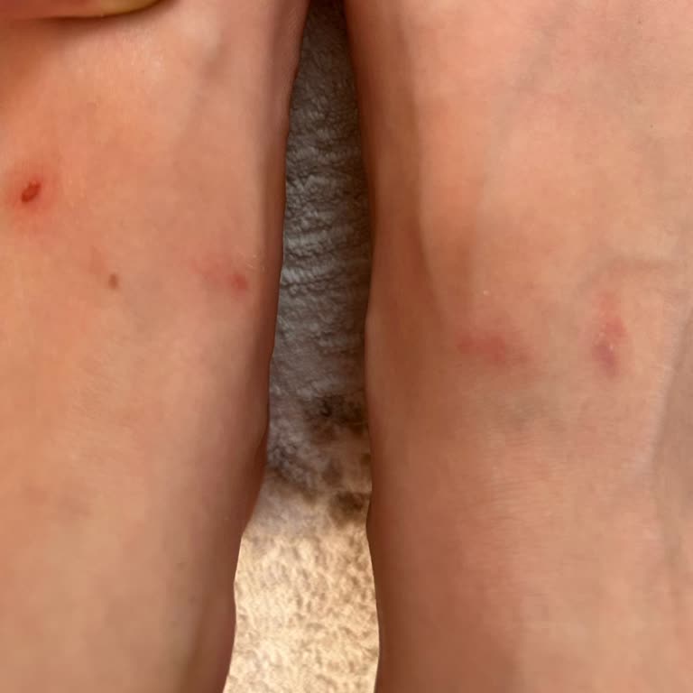 Greyder Terlik Ayağımı Yaraladı, İade Talebim Reddedildi