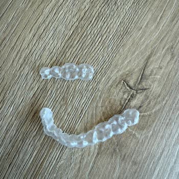 Dentaworld Florya Gece Plağı Kalitesiz Çıktı Tekrar Ödeme İstendi