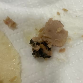 Ton Balığında Yabancı Cisim Şoku