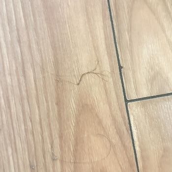 ETS Tur Ve Letoile Beach Hotel’de Sağlık Ve Hijyen Skandalı: Tatilim Zehir Oldu