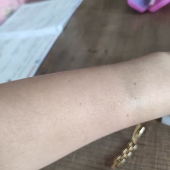 İpekyol Değişim Sonrası Saatte Leke Ve Renk Sorunu, Mağaza Yardımcı Olmadı