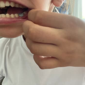 Devlette Yapılan Kanal Tedavisinde Dişim Simsiyah Kaldı