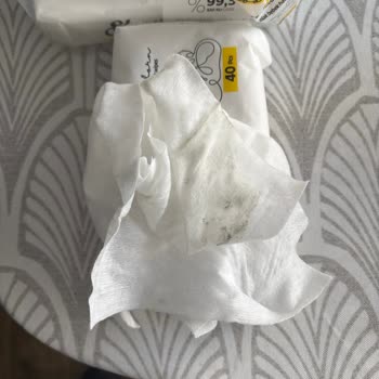 Bebek Islak Mendilinde Küf Şoku: Sleepy Markasına Güvenim Sarsıldı