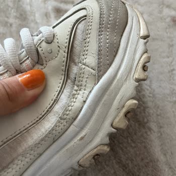 Skechers Ayakkabıda Kısa Sürede Yırtılma Ve Kırılma Yaşadım Firma Sorumluluk Almadı