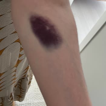 Devlet Hastanesinde Rapor Çilesi Ve Sorumluluk Eksikliği