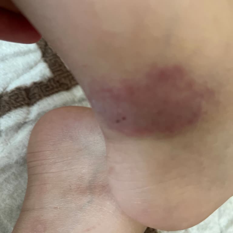 Odalarda Temizlik Ve Hijyen Sorunlarıyla Karşılaştık