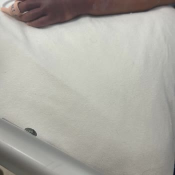 Çocuk Havuzunda Güvenlik İhmali Sonucu Yaşanan Ciddi Kaza Ve Travma