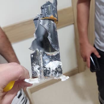 Çocuk Havuzunda Güvenlik İhmali Sonucu Yaşanan Ciddi Kaza Ve Travma