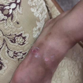 Kemal Tanca Terlik Ürününde Sürekli Rahatsızlık Ve Yetersiz Müşteri Hizmeti