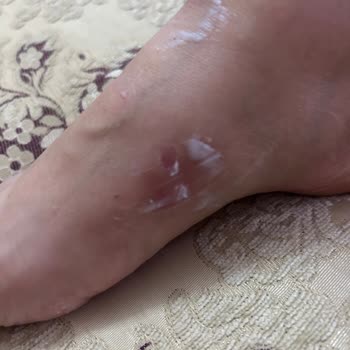 Kemal Tanca Terlik Ürününde Sürekli Rahatsızlık Ve Yetersiz Müşteri Hizmeti