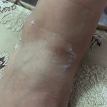 Kemal Tanca Terlik Ürününde Sürekli Rahatsızlık Ve Yetersiz Müşteri Hizmeti