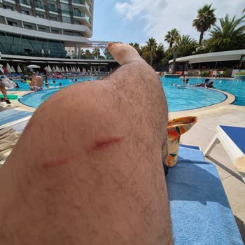 Ultra Lüks Diye Satılan Otelde Buz Yok Hamam Ücretli Yemekler Kalitesiz Bardaklar Pis