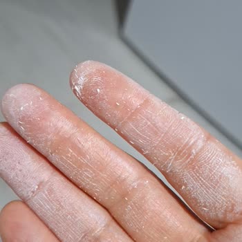 Aldığım Güneş Kremi Orijinal Değil, Satıcıya Ve İdefix'e Ulaşamıyorum