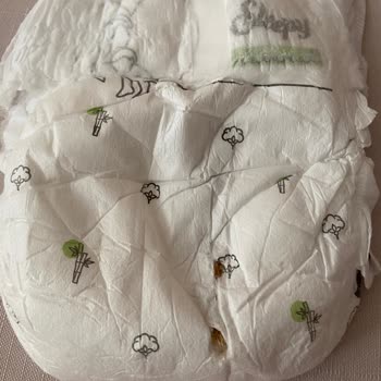 Sleepy Bebek Bezinde Yabancı Madde Ve Toz Sorunu